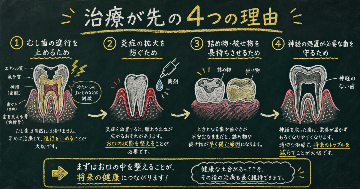 ホワイトニングより「むし歯・歯周病治療」を先に行うべき4つの理由