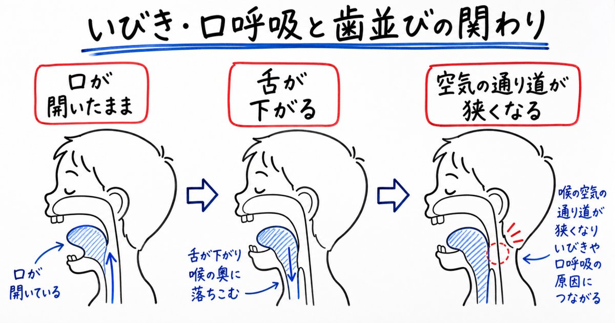 子どものいびきや口呼吸と歯並びの深い関係性