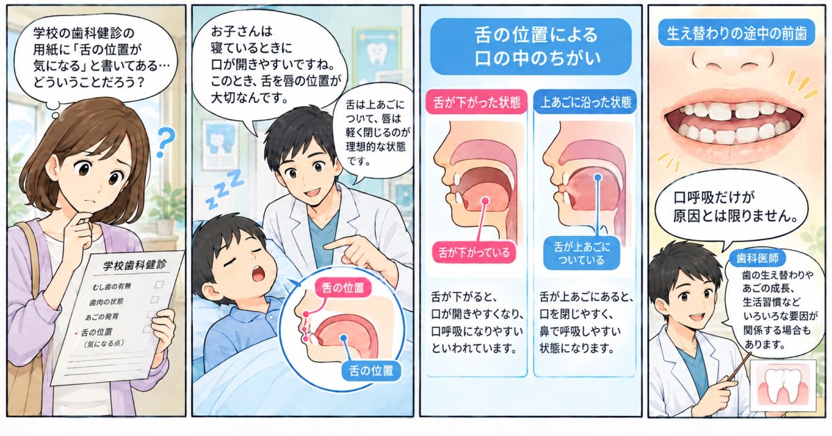 子どもの口呼吸は歯並びに影響する？学校健診の指摘の見方